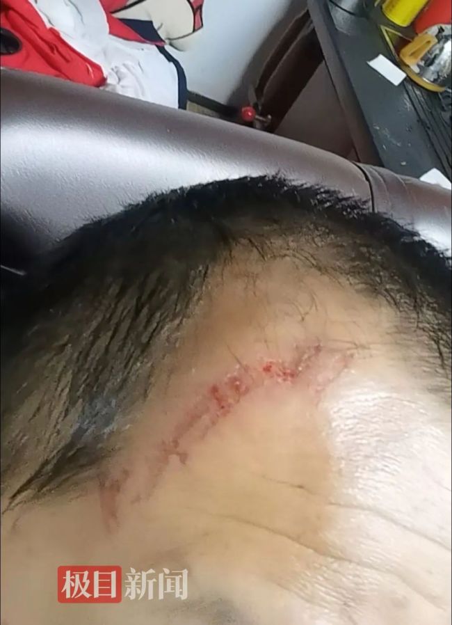 景区飞天魔毯失控游客被甩出 设备故障疑引发事故